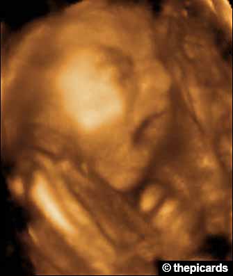 Fetus facial expression