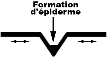 Formation d'épiderme dans un pli cutané