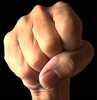 Stretched horizontal folds on clenched fingers