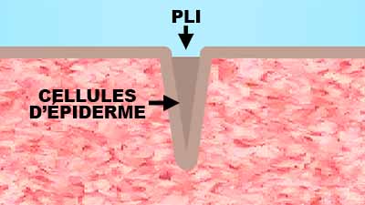 Pli cutané rempli de cellules d'épiderme
