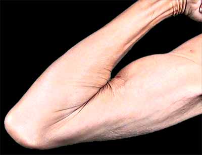 Folded arteries and veins