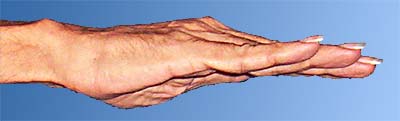 The vertical front/back fold on hand