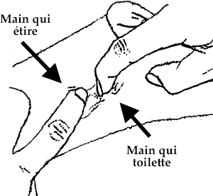 Un doigt étire la peau, alors que l'autre la toilette