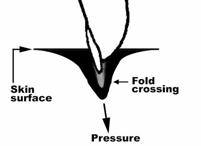 Grooming holes and depressions with pressure strokes