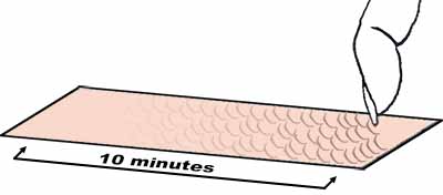 Nail marks should vanish within 10 minutes