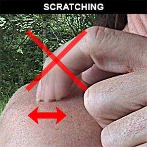 Scratching example