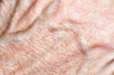 Skin molding the blood vessels