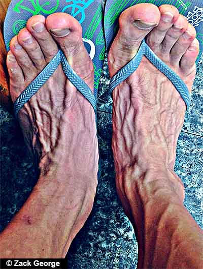 Your skin continuously clamps and clings on your circulatory system